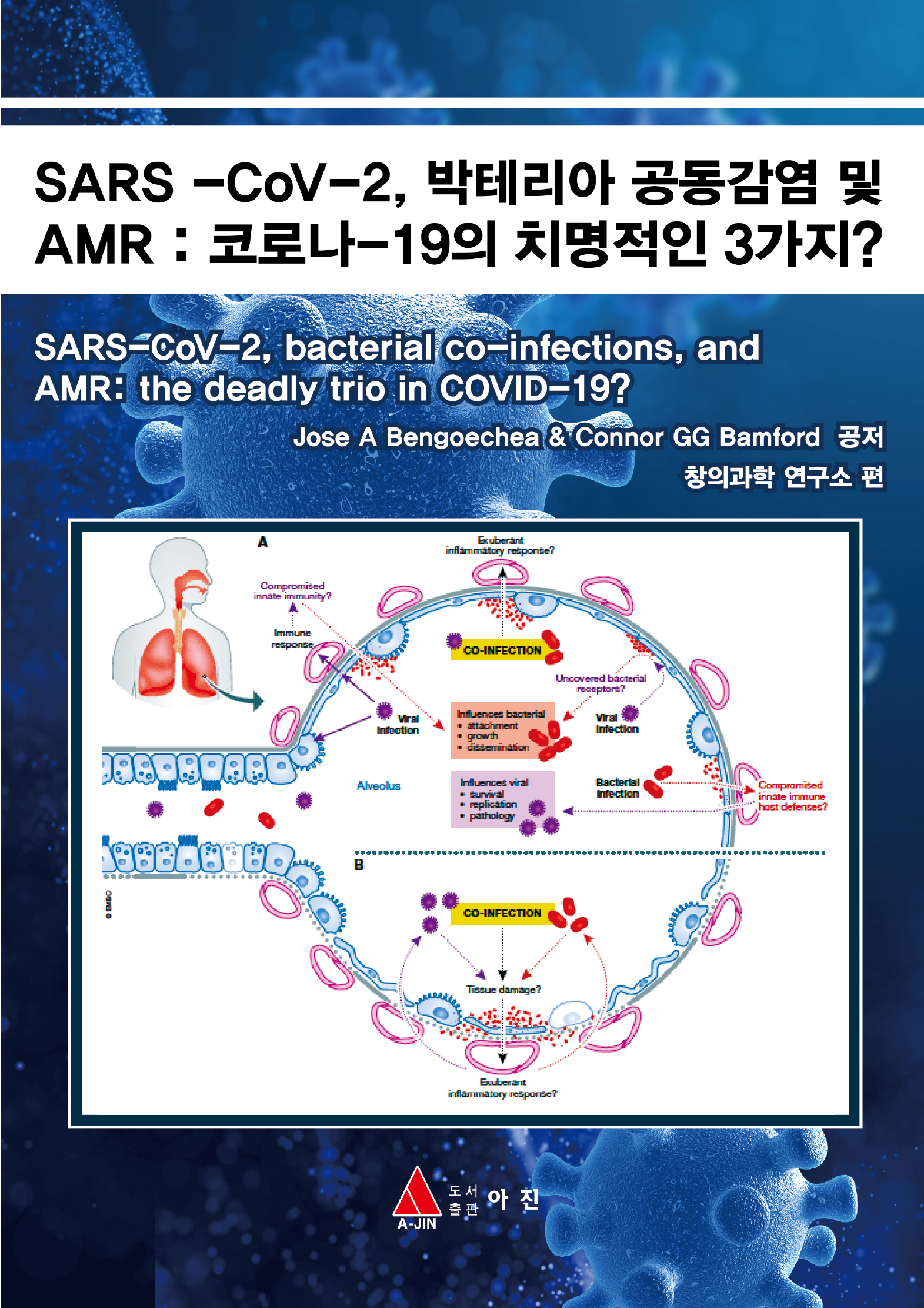 SARS -CoV-2, 박테리아 공동감염 및 AMR : 코로나-19의 치명적인 3가지?