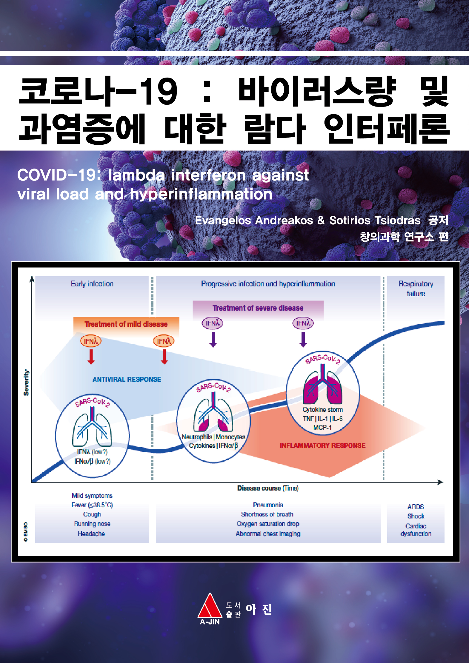 코로나-19 : 바이러스량 및  과염증에 대한 람다 인터페론
