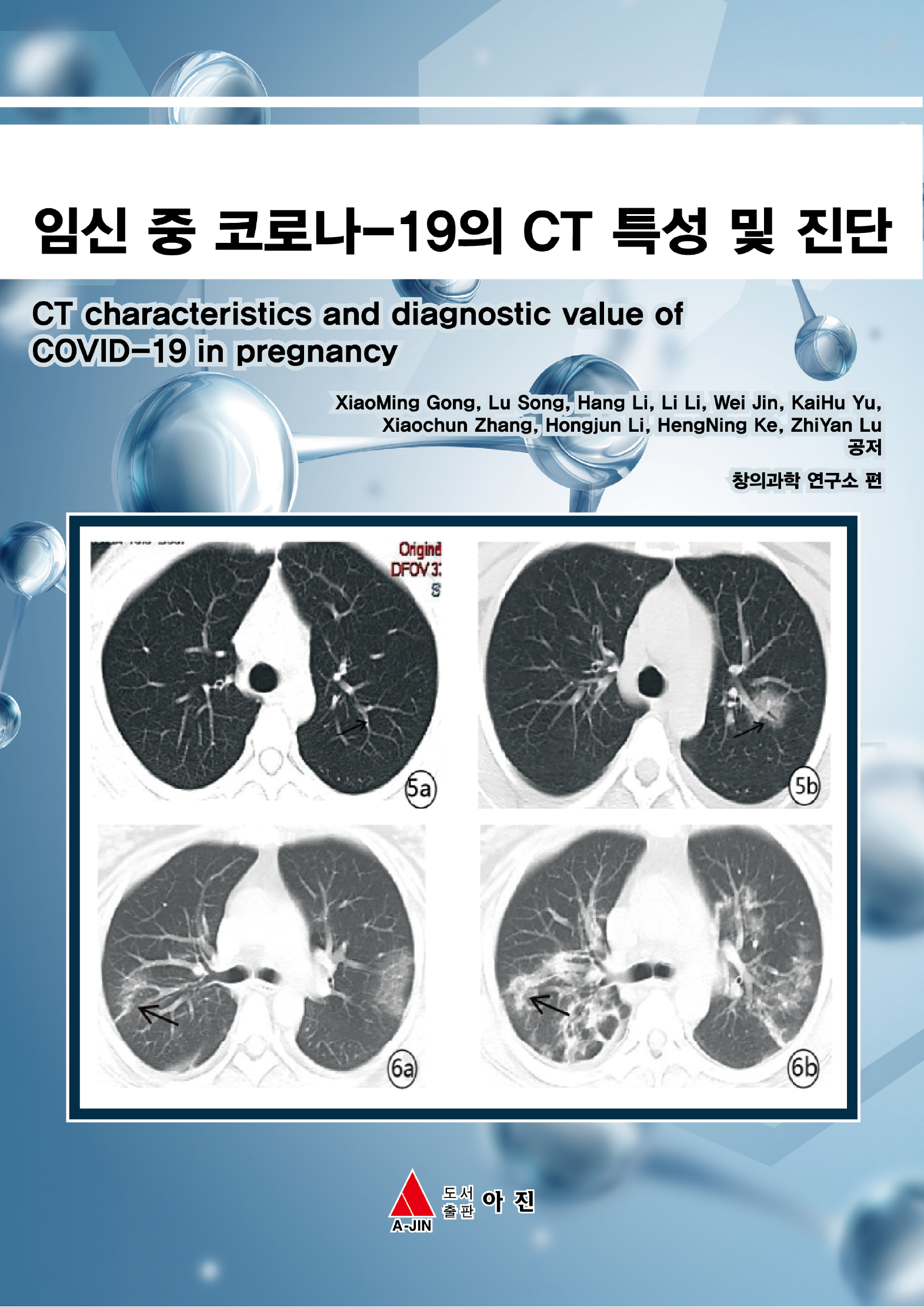 임신 중 코로나-19의 CT 특성 및 진단