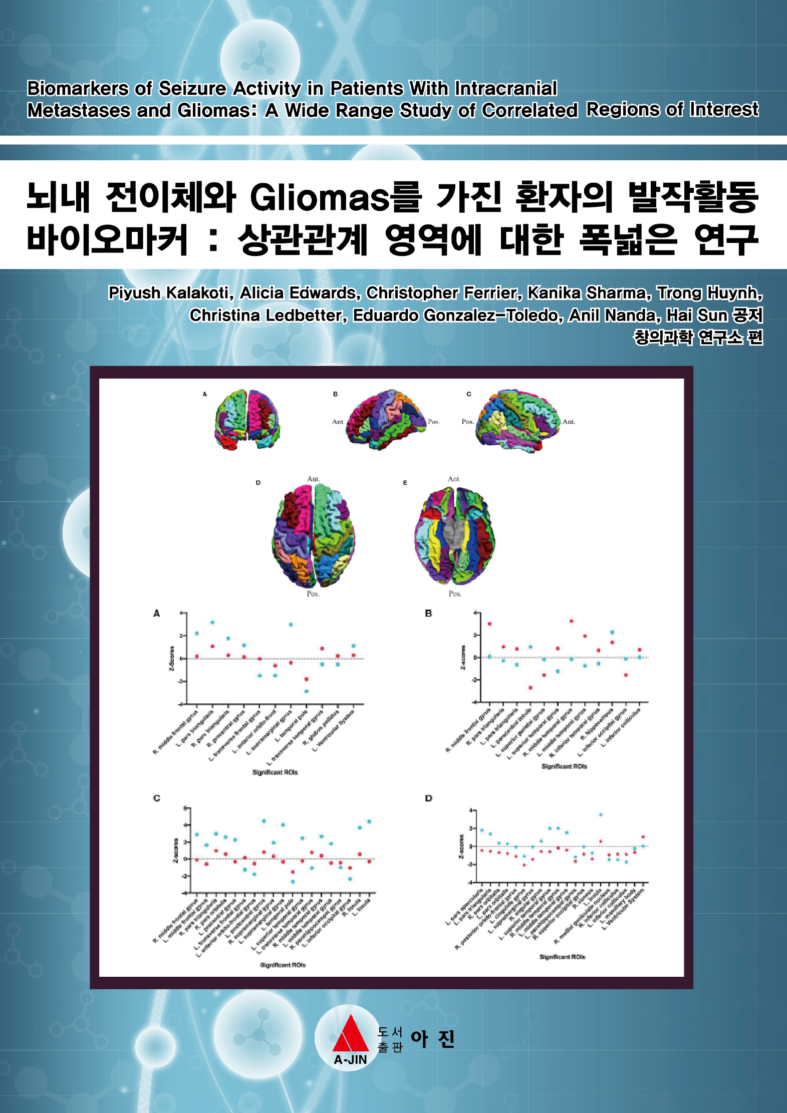 뇌내 전이체와 Gliomas를 가진 환자의 발작활동 바이오마커 : 상관관계 영역에 대한 폭넓은 연구